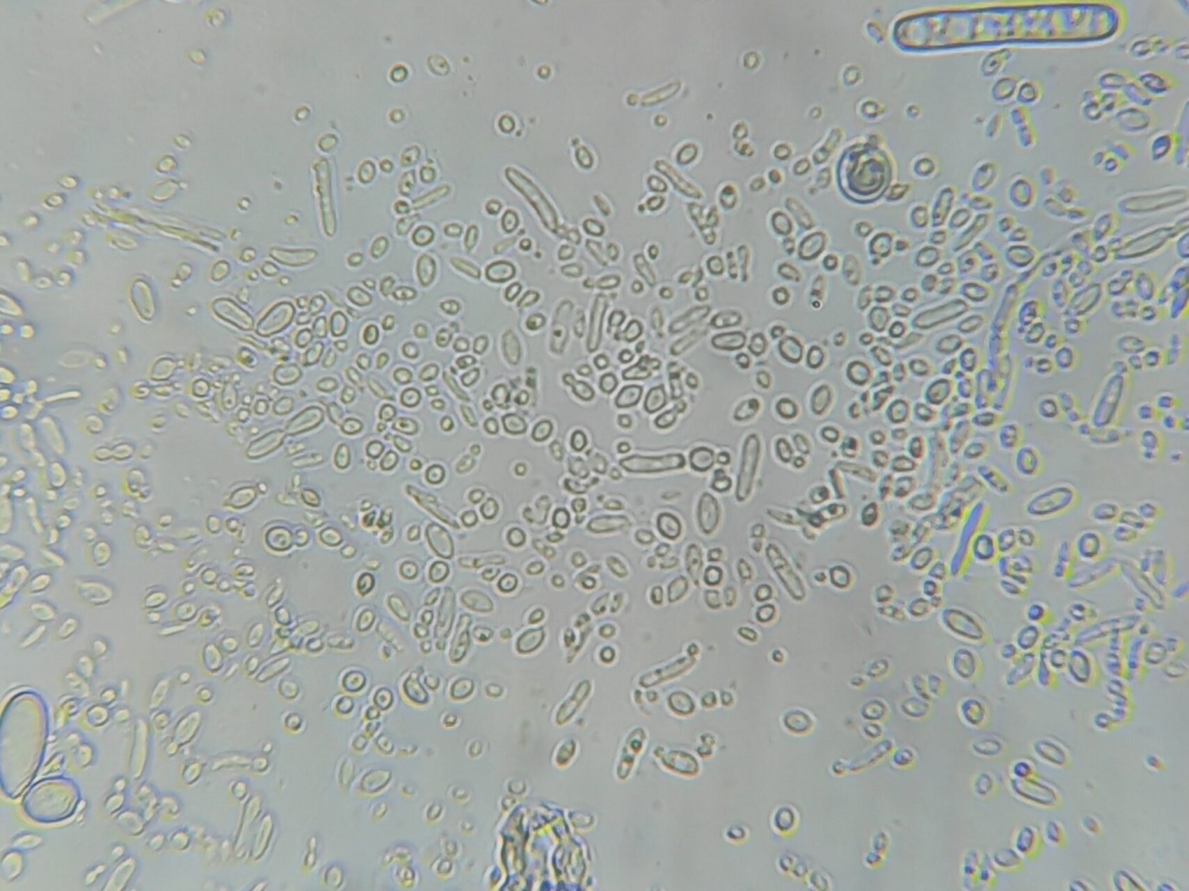 Baker’s Yeast