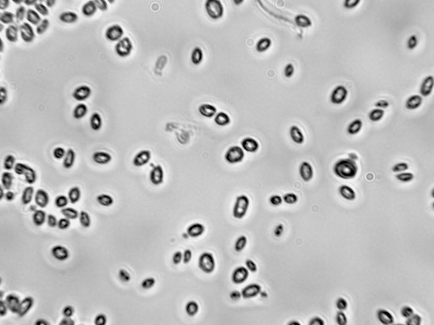 Baker’s Yeast