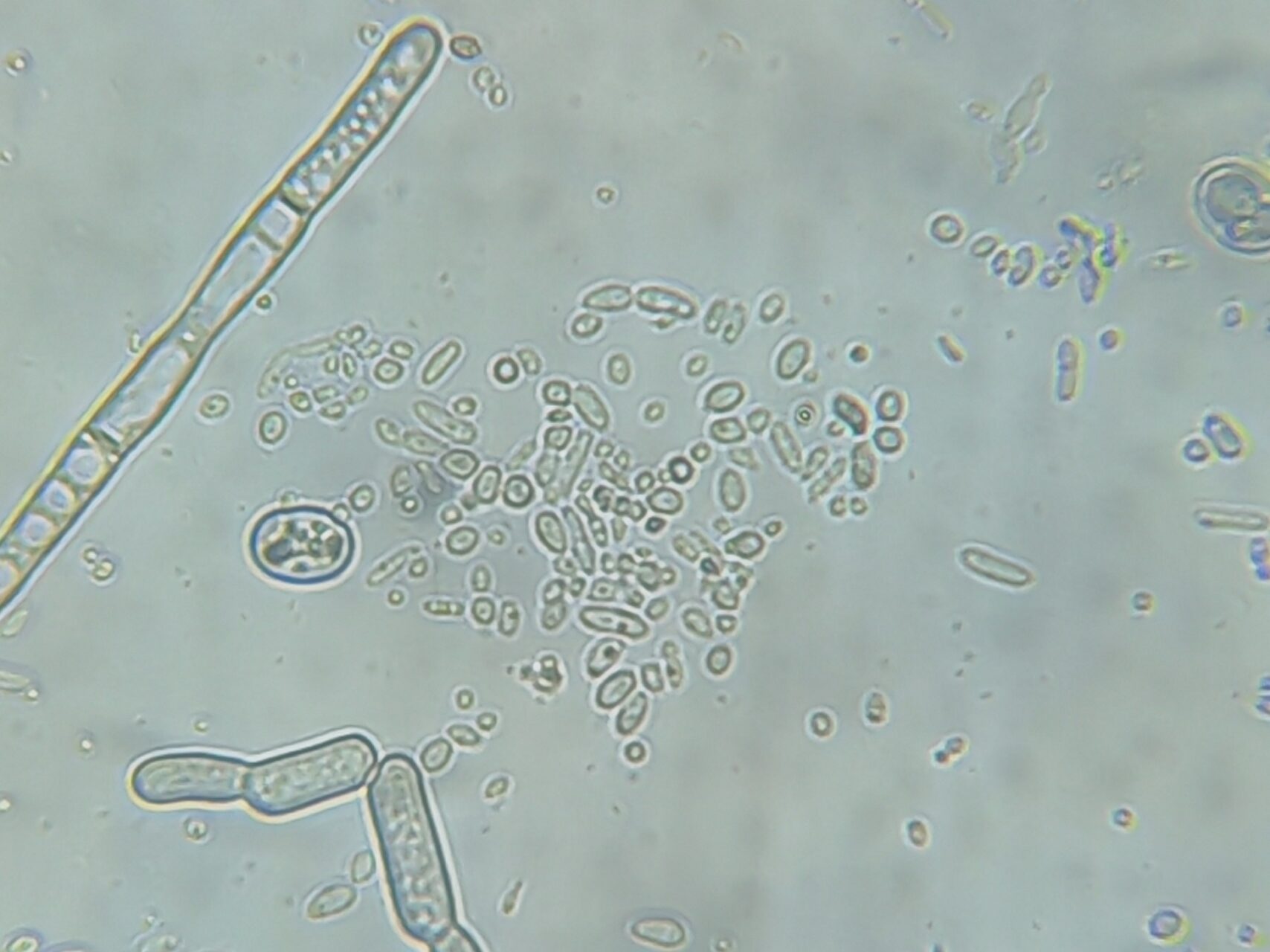Baker’s Yeast