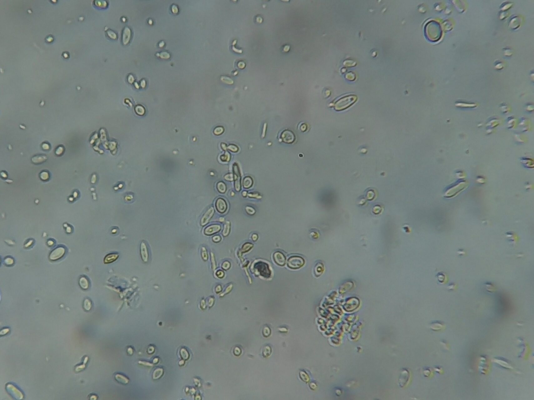 Baker’s Yeast